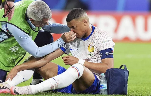 姆巴佩在2024歐洲盃時鼻骨骨折